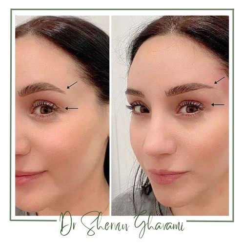 مزایای این جراحی