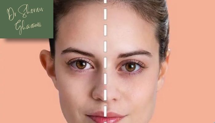 مزایای جراحی اصلاح گوش