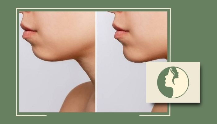 بهترین دکتر پروتز گونه و چانه در تهران با مدرن ترین روش بهترین دکتر پروتز گونه و چانه در تهران با مدرن ترین روش