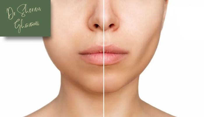 دلایل انجام جراحی دلایل انجام جراحی