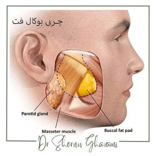 مزایای جراحی بوکال فت مزایای جراحی بوکال فت