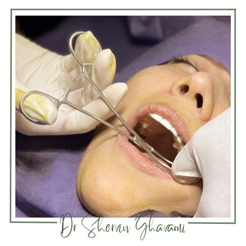 عوارض و خطرات احتمالی عوارض و خطرات احتمالی