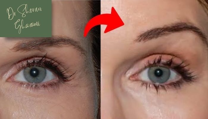 ریسکها و عوارض احتمالی هر روش ریسکها و عوارض احتمالی هر روش