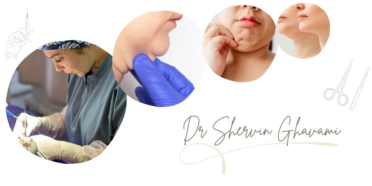 دکتر قوامی بهترین متخصص ساکشن غبغب در سعادت‌آباد تهران