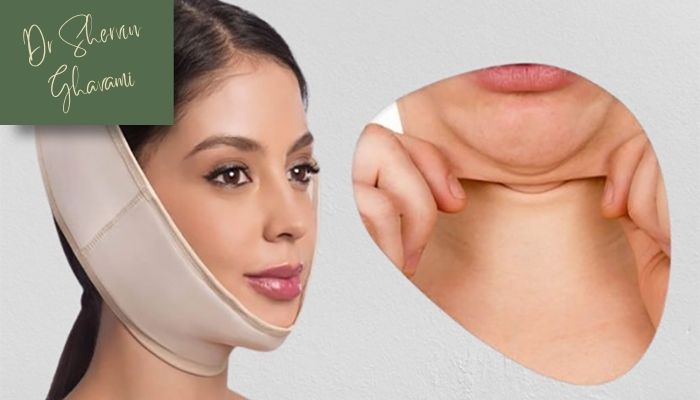 چگونه بعد از ساکشن غبغب از بازگشت چربی پیشگیری کنیم؟