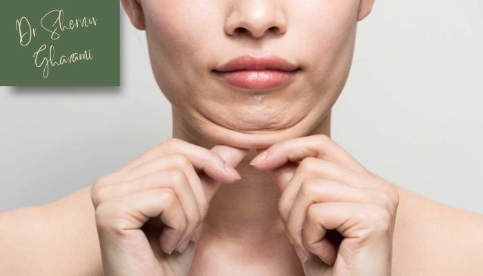 مراقبت‌های پس از ساکشن غبغب
