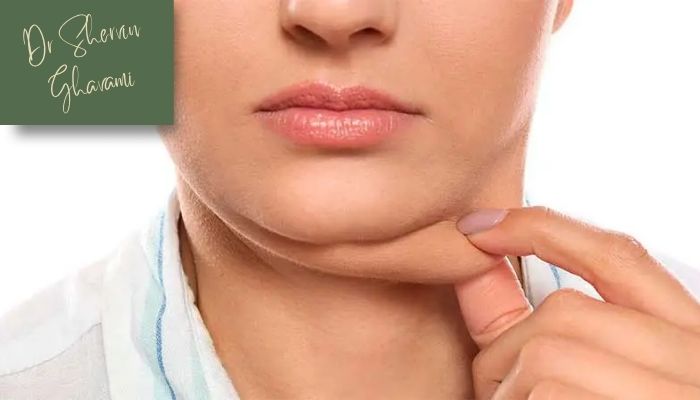 چرا بیماران ساکشن غبغب را انتخاب می‌کنند؟