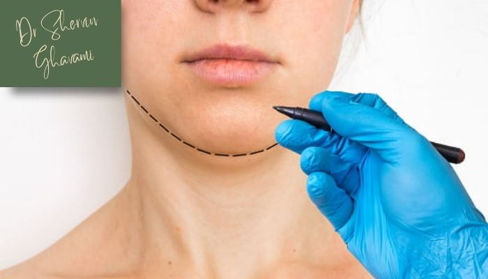 نکات مهم قبل از انجام ساکشن غبغب