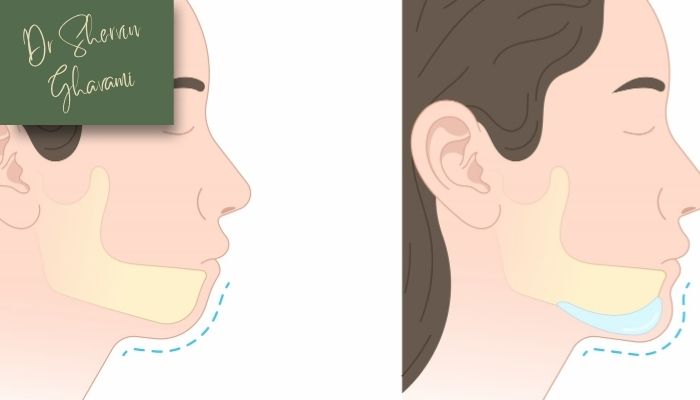 عوارض احتمالی