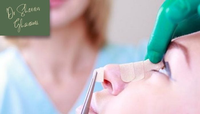 آیا عمل بینی بدون تامپون ممکن است؟