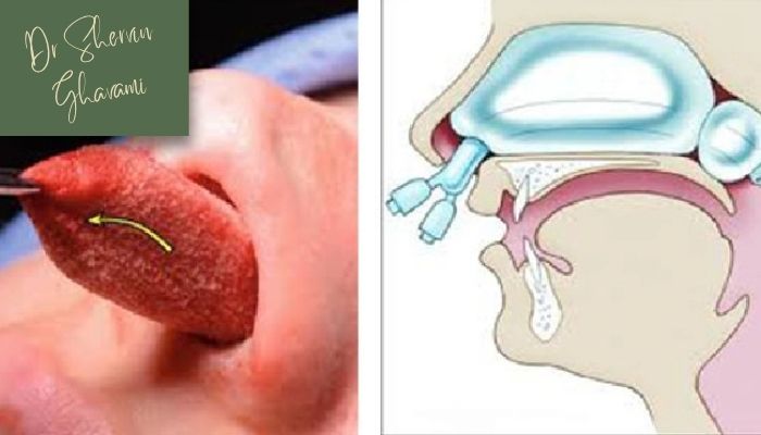 تامپون بینی چیست و چرا استفاده می‌شود؟