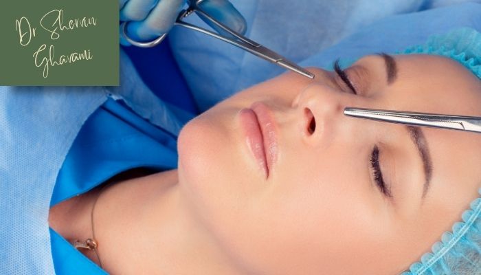 مزایا عمل بینی بدون تامپون