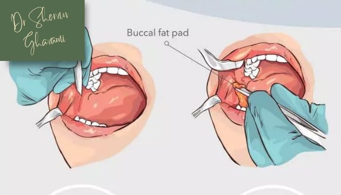 مراقبت‌های لازم پس از جراحی