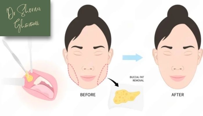 عوامل مؤثر بر تغییرات گونه پس از جراحی