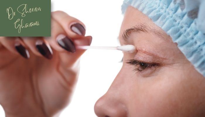 مراقبت‌های بعد از جراحی پلک