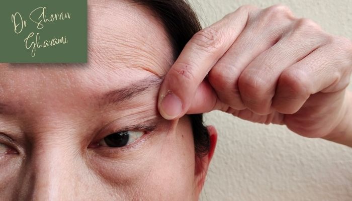 علائم و نشانه‌های افتادگی پلک