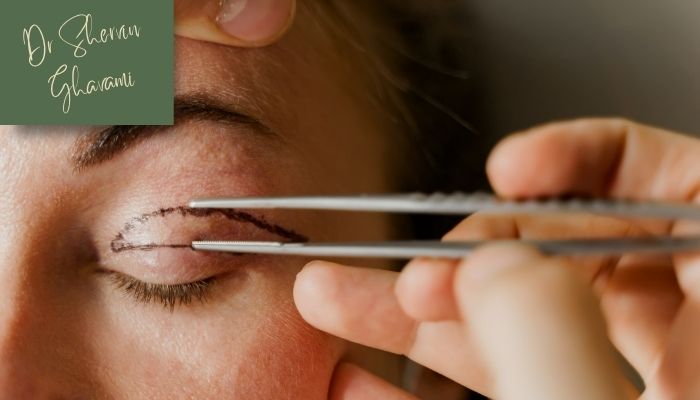 زمان مناسب برای انجام عمل پلک