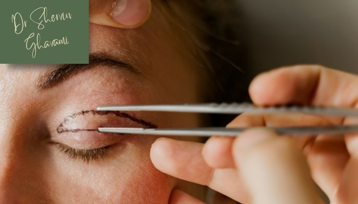 مقایسه بلفاروپلاستی با لیزر و جراحی سنتی مقایسه بلفاروپلاستی با لیزر و جراحی سنتی