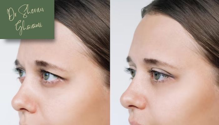 مزایای روش بلفاروپلاستی سنتی  مزایای روش بلفاروپلاستی سنتی