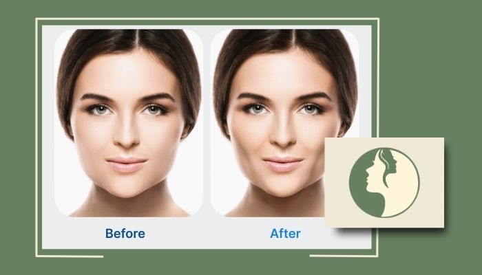 آیا بوکال فت برگشت دارد؟ بررسی تجربه بیماران