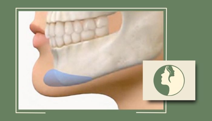 بایدها و نباید های پروتز چانه و افراد مناسب برای انجام آن