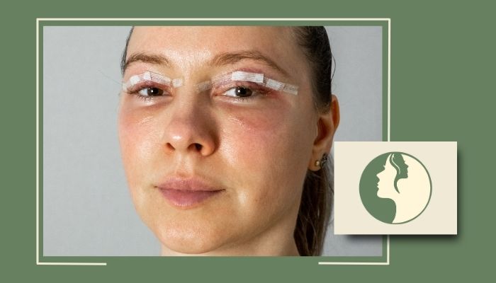 بلفاروپلاستی با لیزر بهتر است یا جراحی سنتی؟ مقایسه این دو روش