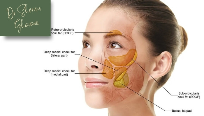 مقایسه بوکال فت و فیلر گونه مقایسه بوکال فت و فیلر گونه
