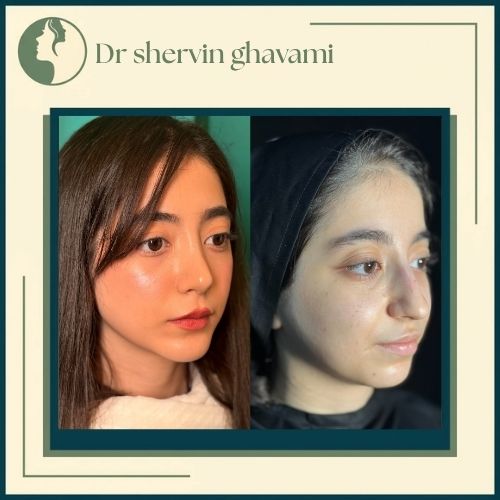 جراحی بینی و ژنیوپلاستی