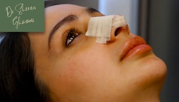 علت های اصلی بوی نامطبوع بینی علت های اصلی بوی نامطبوع بینی